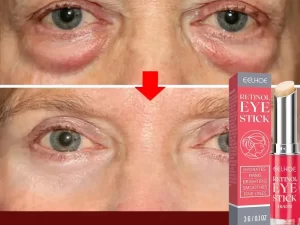 Retinol Eye Bags Cream Care