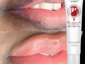 Whitening, Moisturizing & for Beautiful Lips
