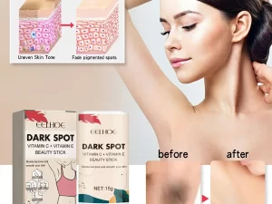 Body Whitening Bleach Cream Removal