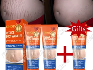 Stretch Marks Permanent Removal Cream