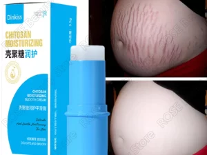 Stretch Mark Repair Cream Skin Care