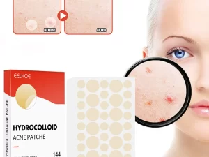 144-Piece Acne Pimple Patch