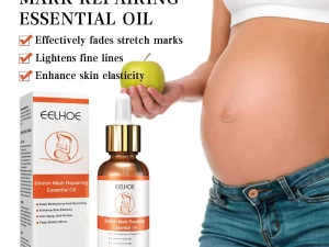 Eliminate Old Stretch Marks Cream